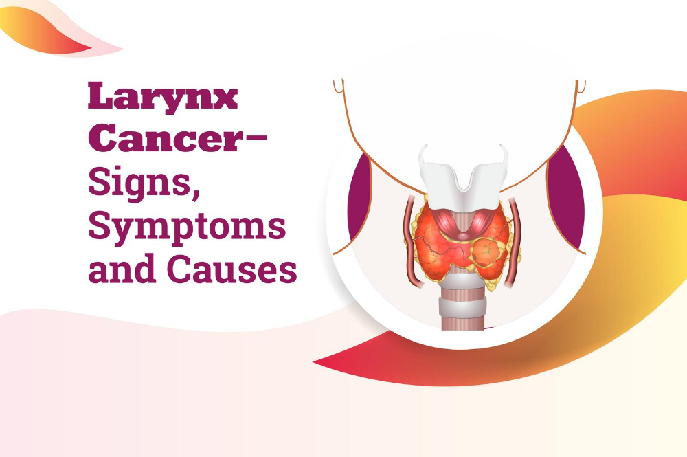 Early Signs Of Larynx Cancer Its Stages And Symptoms Cadila 